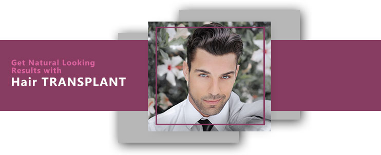 hair transplant in delhi